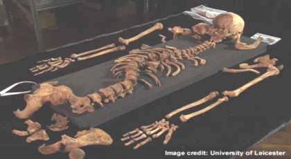 Examination of bones of Richard III